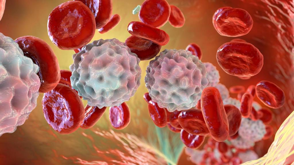 Cansancio, infecciones y moretones: señales de alerta sobre enfermedades hematológicas