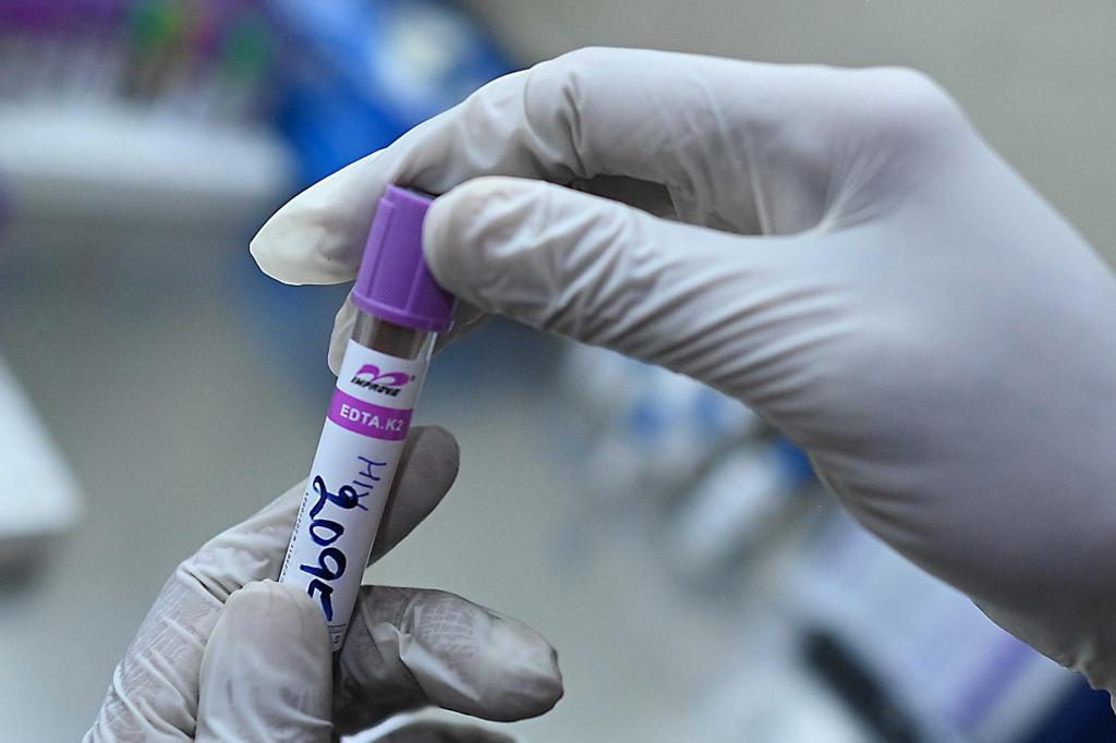 Salud emite orden administrativa ante la escasez de pruebas de detección de tuberculosis